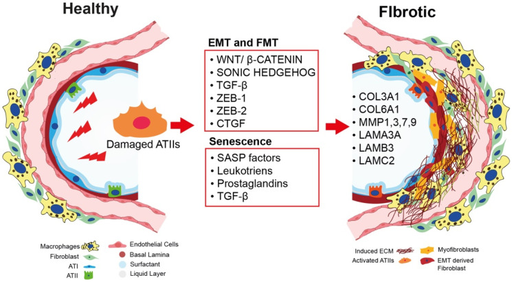 Uncovering the Mechanism of Pulmonary Fibrosis